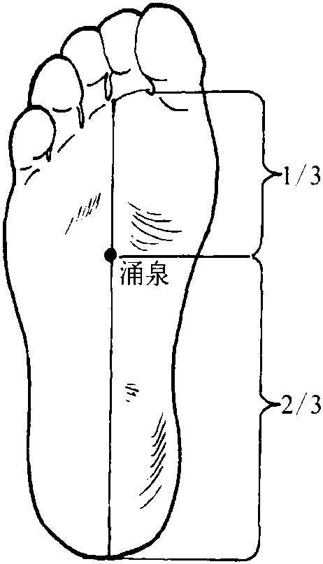 第三十二節(jié) 2型糖尿病